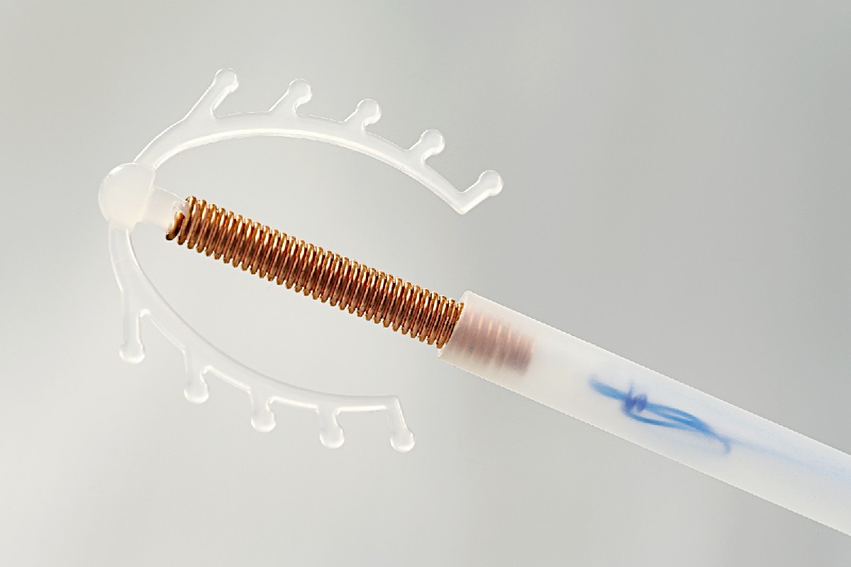 Kupferspirale, Verhütung Spirale, hormonfreie Verhütung, Gynefix, Kupferball, Multiload